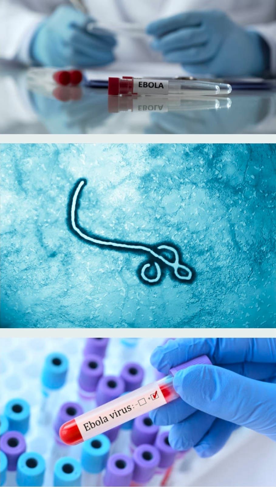 Virus da Ébola, Nigéria reforça protocolos de vigilância